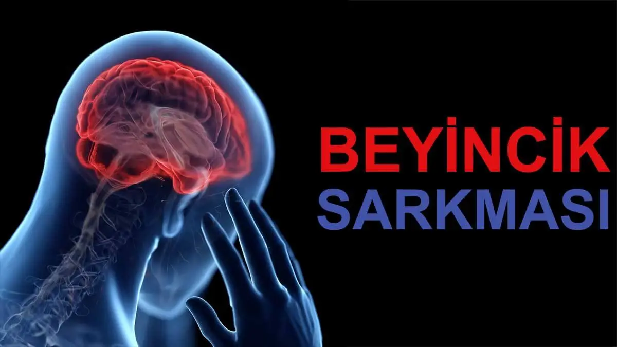 Beyincik Sarkması